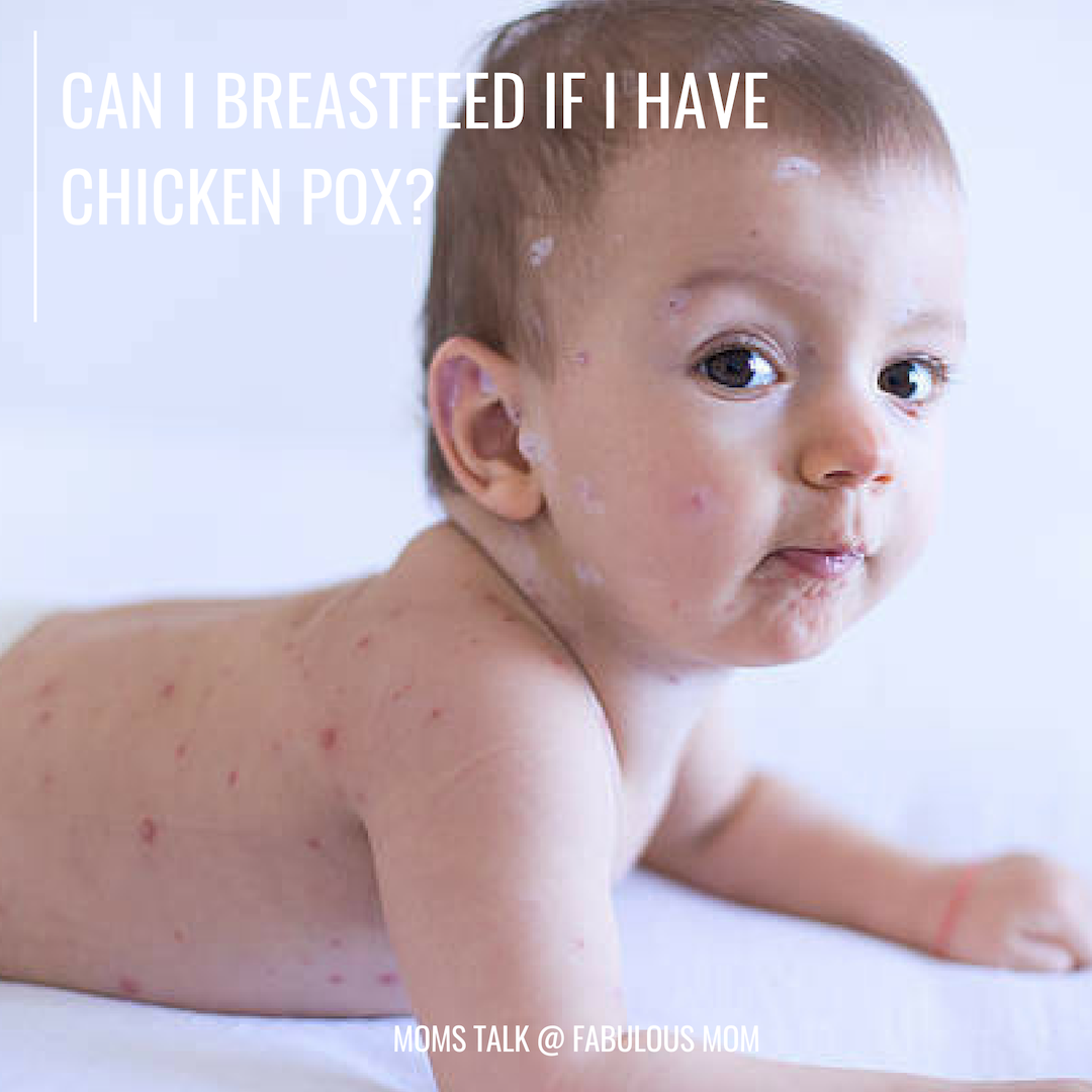 Can I Breastfeed If I have Chicken Pox?